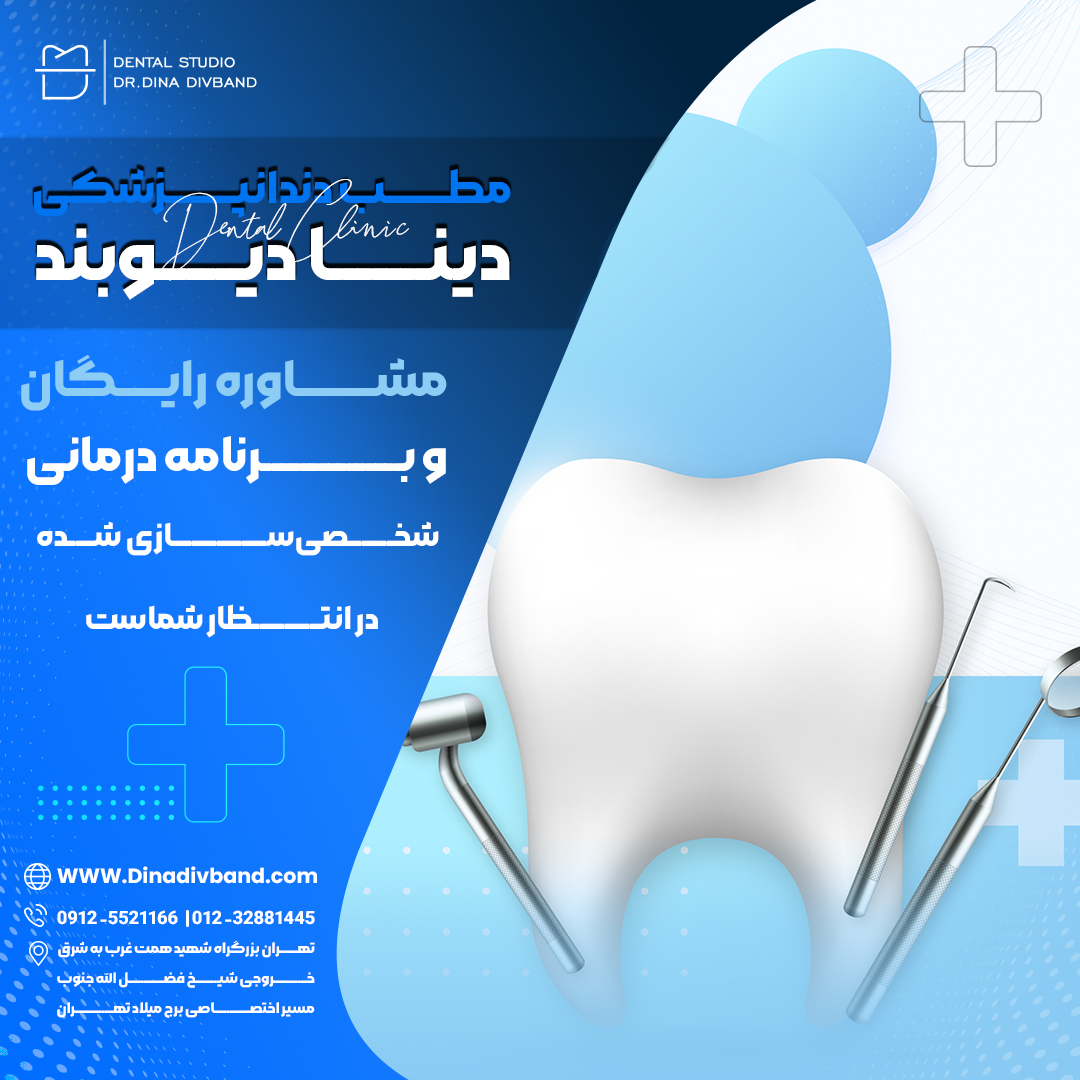 انواع ونیرهای کامپوزیت