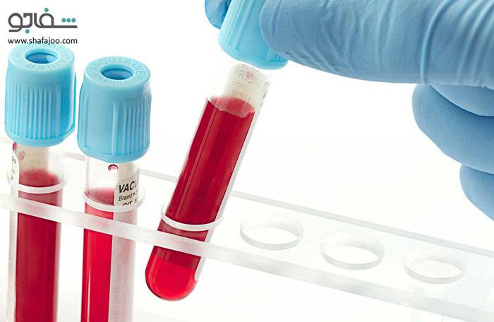 هپاتیت ویروسی - Hepatitis viral
