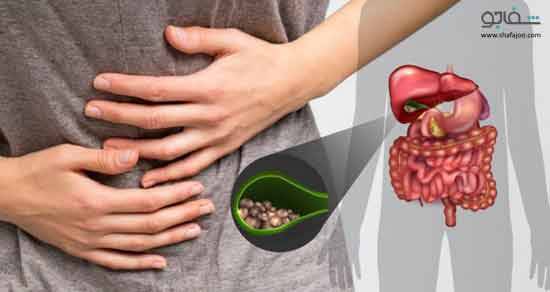 سنگ کیسه صفرا ، علل ،علائم و پیشگیری