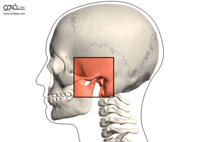 نشانگان مفصل گیجگاهی ـ فکتحتانی - temporomandibular joint(tmj)syndrome