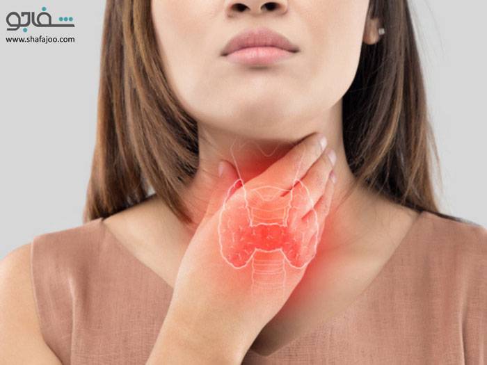 گرهک‌(ندول) تیروییدی‌ - thyroid nodule