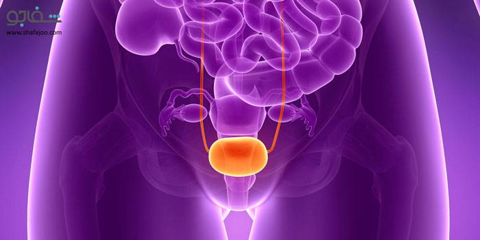 تومور مثانه - Bladder tumor