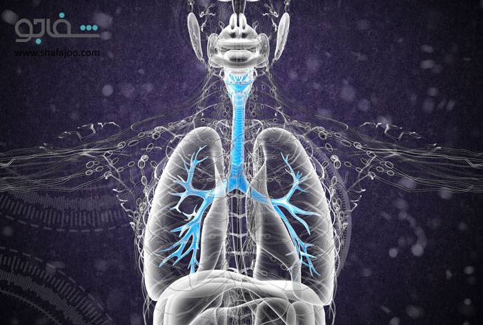 برونشکتازی‌ - bronchiectasis