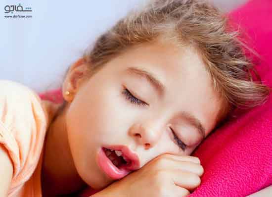 لوزه سوم چیست؟ علل، علائم و درمان لوزه سوم
