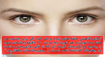 کاهش پف کردگی و تیرگی زیر چشم با چای کیسه ای! کاهش پف کردگی و تیرگی زیر چشم با چای کیسه ای!
