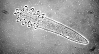 دمودکس ، انگل ۸ پایی که شب‌ها سراغ پوست انسان می‌آید