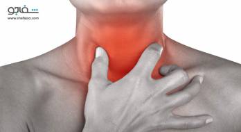اپیگلوتیت - Epiglottitis اپیگلوتیت - Epiglottitis