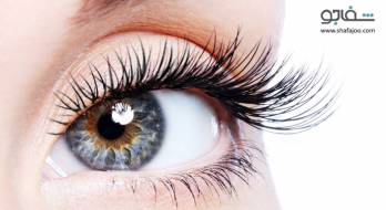 آب مروارید - cataract آب مروارید - cataract