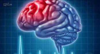 آبسه مغزی یا اپیدورال - brain or epidural abscess آبسه مغزی یا اپیدورال - brain or epidural abscess