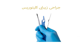 فواید هودکتومی چیست؟ فواید هودکتومی چیست؟