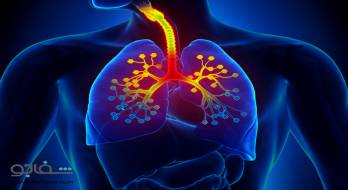 برونشیت حاد - bronchitis acute برونشیت حاد - bronchitis acute