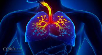 برونشیت‌ حاد - bronchitis acute