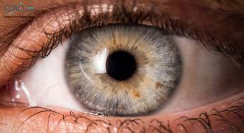 جسم خارجی در چشم - Eye foreign body in جسم خارجی در چشم - Eye foreign body in
