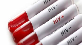 برای تشخیص HIV چه آزمایشاتی میتوان انجام داد؟ برای تشخیص HIV چه آزمایشاتی میتوان انجام داد؟