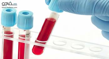 هپاتیت ویروسی - Hepatitis viral هپاتیت ویروسی - Hepatitis viral