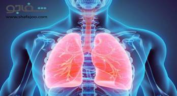 پنومونی مایکوپلاسمایی (پنومونی غیرمعمول) - pneumonia mycoplasmal پنومونی مایکوپلاسمایی (پنومونی غیرمعمول) - pneumonia mycoplasmal