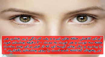 کاهش پف چشم کاهش پف چشم