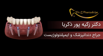 مشکلات و عوارض عصب کشی دندان مشکلات و عوارض عصب کشی دندان