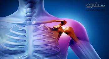 تاندونیت و تنوسینوویت - tendinitis and tenosynovitis تاندونیت و تنوسینوویت - tendinitis and tenosynovitis
