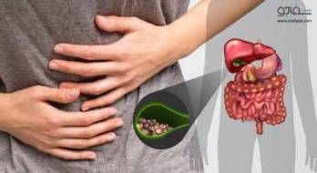 سنگ کیسه صفرا ، علل ،علائم و پیشگیری سنگ کیسه صفرا ، علل ،علائم و پیشگیری