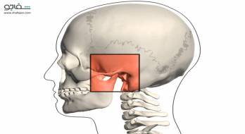نشانگان مفصل گیجگاهی ـ فکتحتانی - temporomandibular joint(tmj)syndrome نشانگان مفصل گیجگاهی ـ فکتحتانی - temporomandibular joint(tmj)syndrome