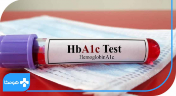 تشخیص دیابت با انجام آزمایش HbA1C تشخیص دیابت با انجام آزمایش HbA1C