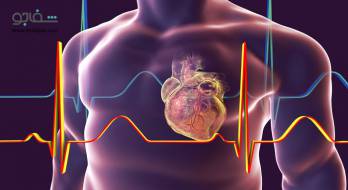 آندوکاردیت - Endocarditis آندوکاردیت - Endocarditis