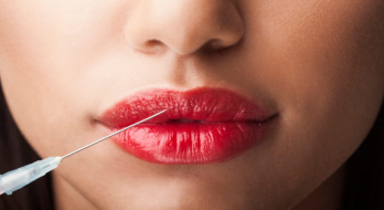 فرم دهی عالی لب با ژل لب روسی فرم دهی عالی لب با ژل لب روسی