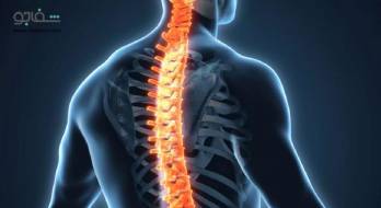 اسکولیوز (انحنای‌ ستون‌ فقرات‌) - scoliosis