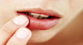 تبخال یا زخم سرماخوردگی(زکام) چیست؟ تبخال یا زخم سرماخوردگی(زکام) چیست؟
