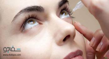 آب سیاه چشم، نوع زاویه بسته اولیه - glaucoma primary angle closure آب سیاه چشم، نوع زاویه بسته اولیه - glaucoma primary angle closure