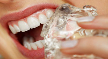 ١٩ عادت اشتباه که باعث خراب شدن دندانها می شود