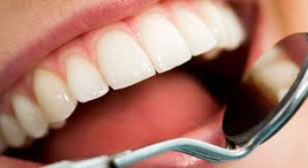 4 نکته که  دهان می تواند  در مورد سلامتی شما بگوید