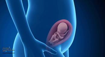بیرونزدگی رحم - uterine prolapse بیرونزدگی رحم - uterine prolapse
