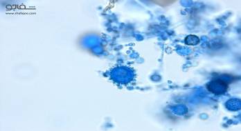 هیستوپلاسموز - Histoplasmosis هیستوپلاسموز - Histoplasmosis