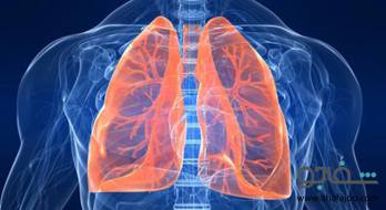 سل (توبرکولوز) - tuberculosis(tb) سل (توبرکولوز) - tuberculosis(tb)
