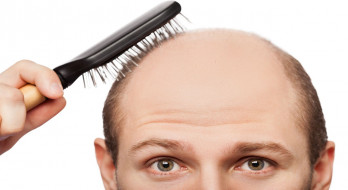 علل اصلی ریزش مو چه هستند و چه باید کرد؟