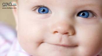 انحراف چشم - strabismus انحراف چشم - strabismus