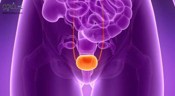 تومور مثانه‌ - Bladder tumor