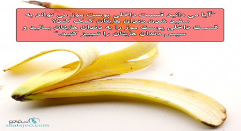 پوست موز و سفیدی دندان ها پوست موز و سفیدی دندان ها