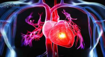 بیماری دریچهای قلب - Heart valve disease بیماری دریچهای قلب - Heart valve disease