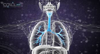 برونشکتازی - bronchiectasis برونشکتازی - bronchiectasis