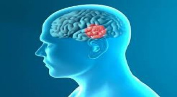 دوپامین چیست؟ دوپامین چیست؟