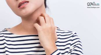 اگزما - Eczema اگزما - Eczema