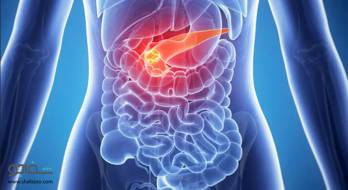 پورفیری - porphyriapotassium imbalance پورفیری - porphyriapotassium imbalance
