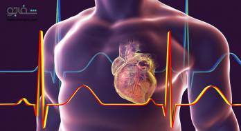ایست قلبی - cardiac arrest ایست قلبی - cardiac arrest