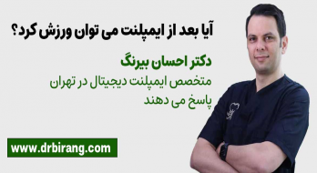 ورزش و پیاده روی بعد از ایمپلنت ورزش و پیاده روی بعد از ایمپلنت