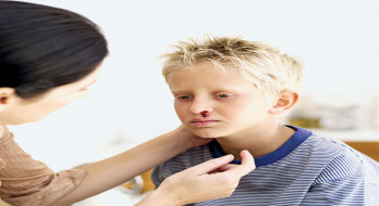 آنچه در مورد خون دماغ شدن کودکان باید بدانید آنچه در مورد خون دماغ شدن کودکان باید بدانید