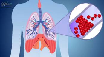 بیماری ناشی از کاهش ناگهانی فشار - decompression sickness بیماری ناشی از کاهش ناگهانی فشار - decompression sickness
