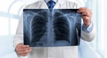 پنومونی ویروسی - pneumonia viral پنومونی ویروسی - pneumonia viral